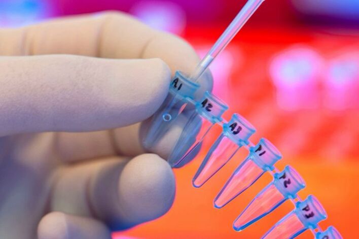 Welche Tests werden für Parasiten durchgeführt