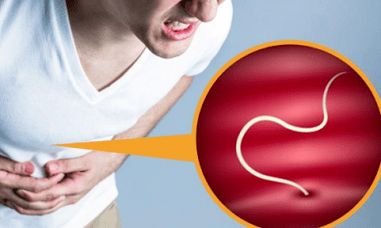 Parasitensymptome beim Menschen