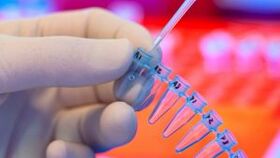 Wie man den Parasiten -Test durchführt