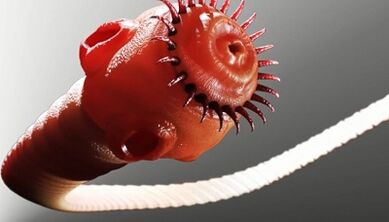 Arten von Parasiten im menschlichen Körper