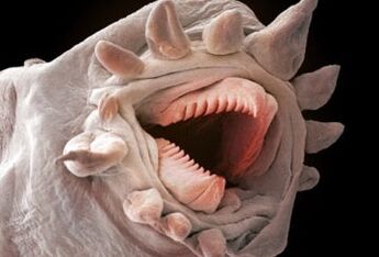 Welche Würmer können im menschlichen Körper leben