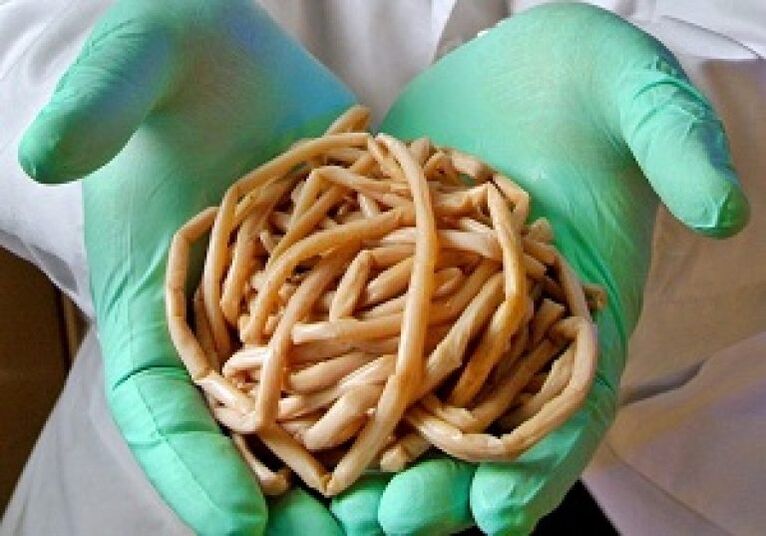 Parasitäre Würmer des menschlichen Körpers.